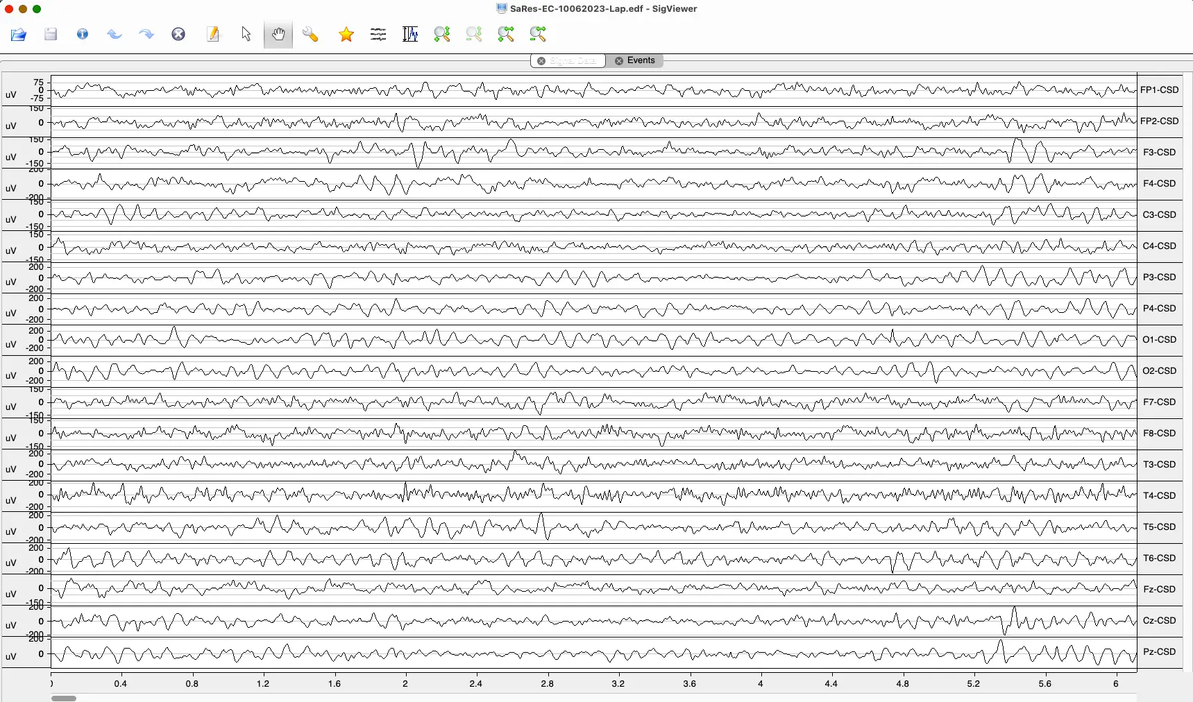 EEG Setup