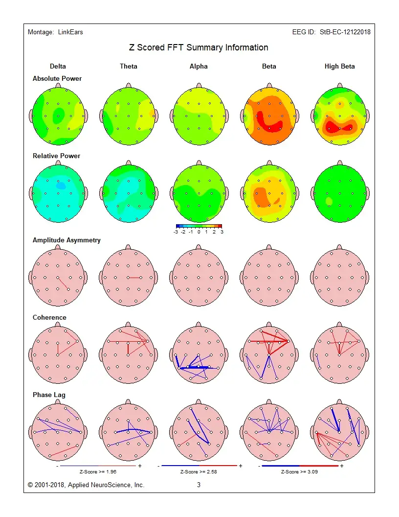 Training My Brain: A Great Science Experiment