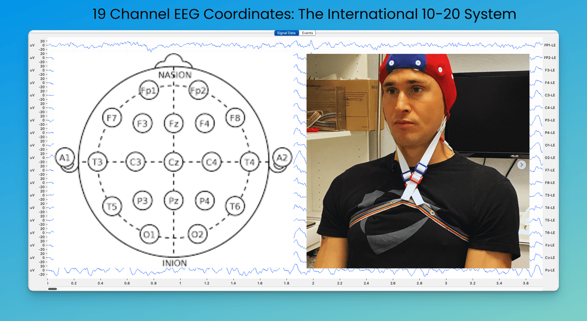 Neuroguide Eeg Reading Your Own QEEG Brain Map | Peak Brain Institute